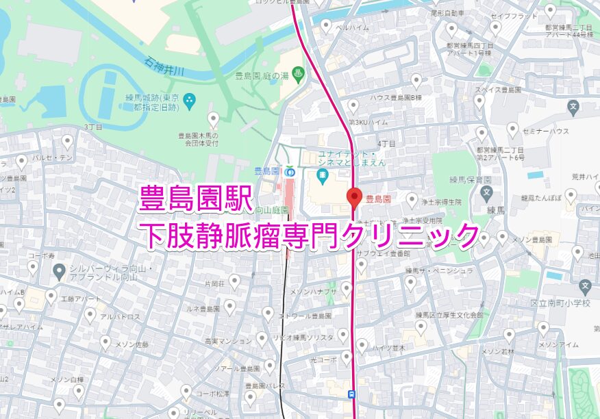 豊島園駅周辺の下肢静脈瘤専門クリニック