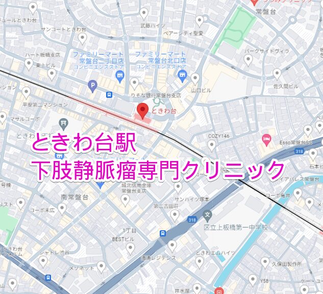 ときわ台駅周辺の下肢静脈瘤専門クリニック