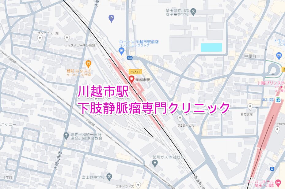 川越市駅から通える下肢静脈瘤専門クリニック