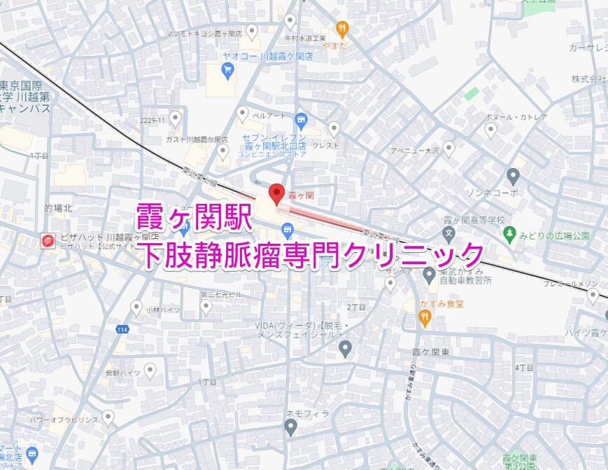 霞ヶ関駅から通える下肢静脈瘤専門クリニック