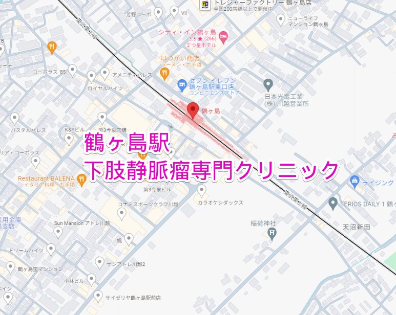 鶴ヶ島駅周辺の下肢静脈瘤専門クリニック