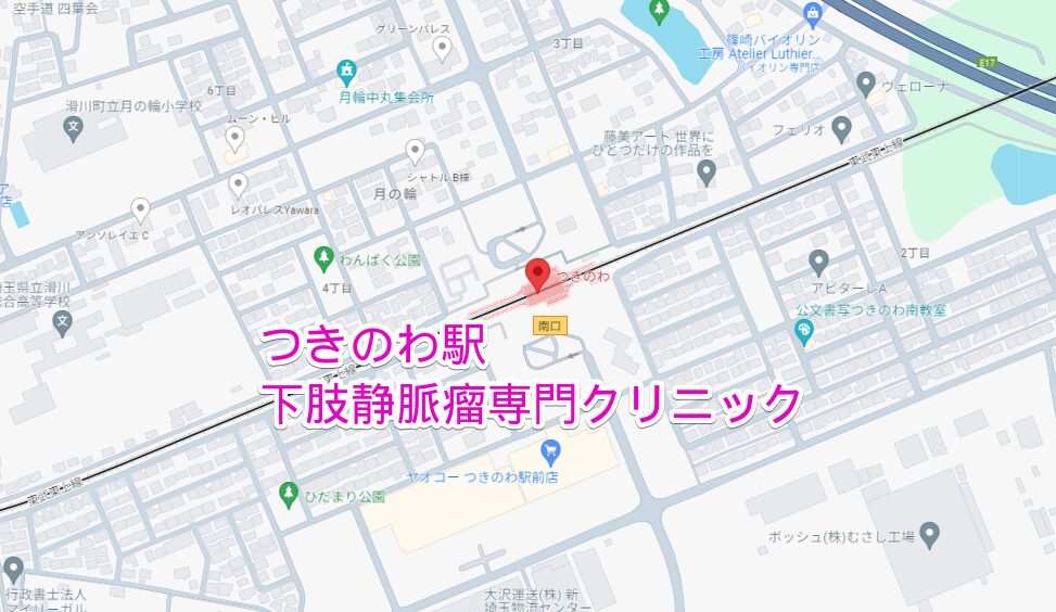 つきのわ駅周辺の下肢静脈瘤専門クリニック