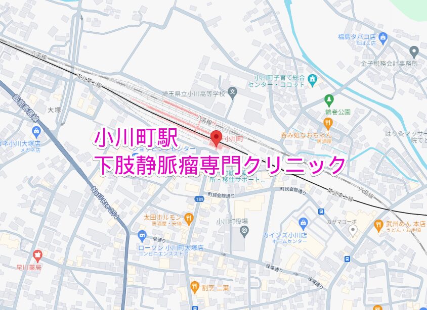 小川町駅から通える下肢静脈瘤専門クリニック