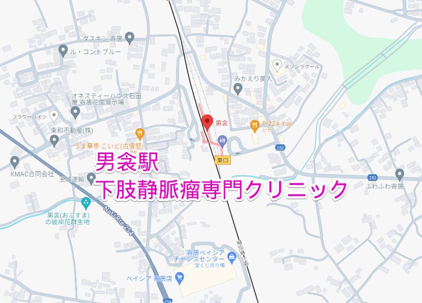 男衾駅から通院する下肢静脈瘤専門クリニック