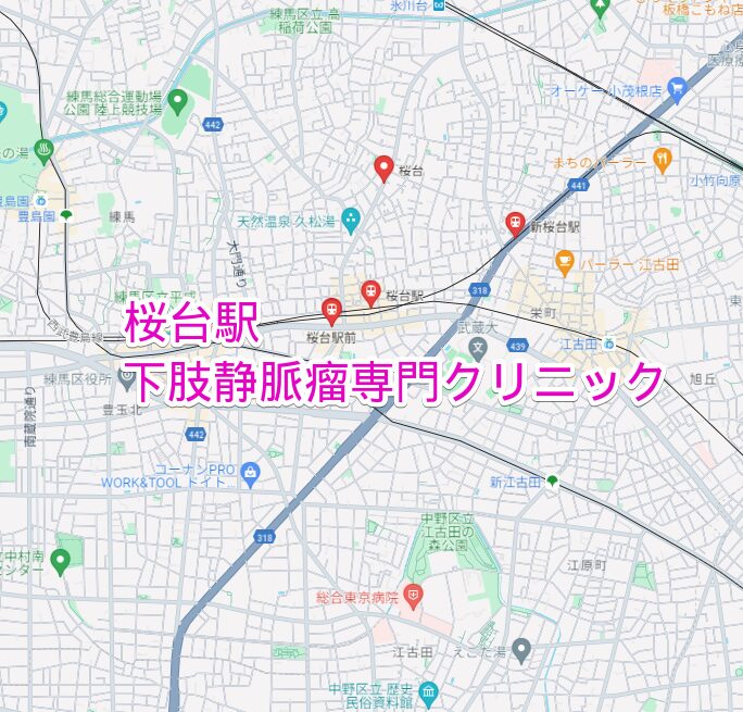 桜台駅周辺の下肢静脈瘤専門クリニック
