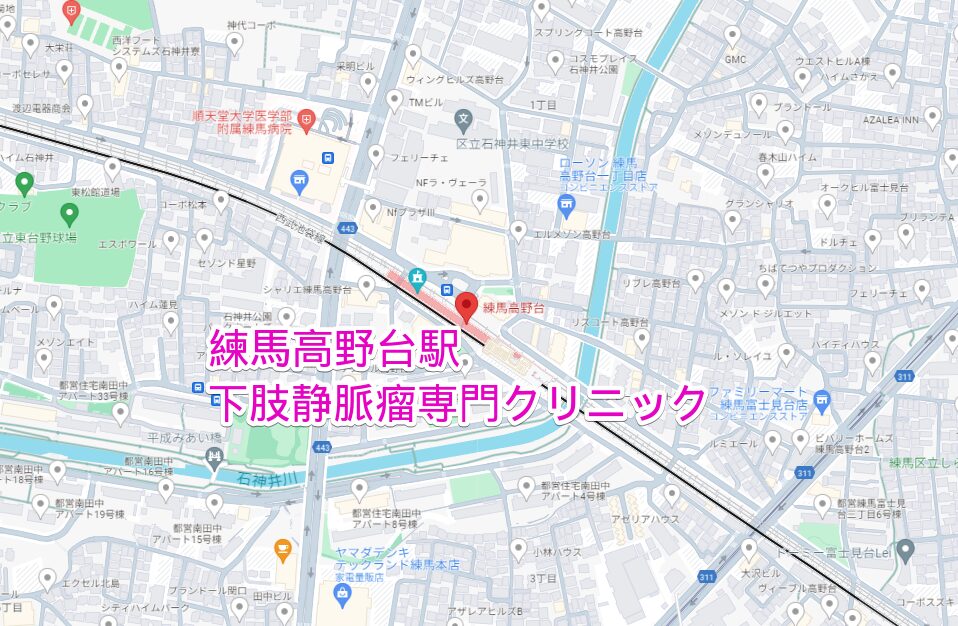 練馬高野台駅周辺の下肢静脈瘤専門クリニック