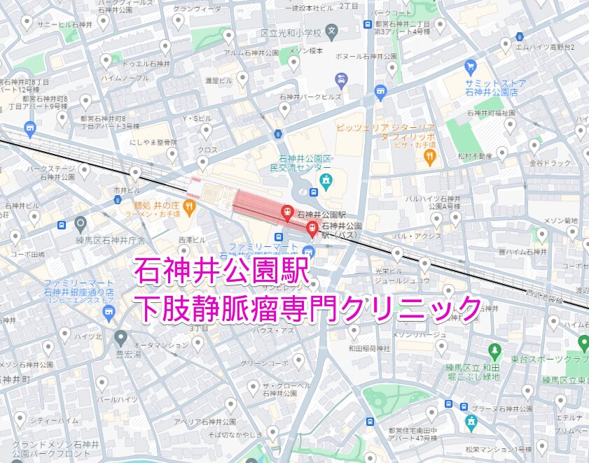 石神井公園駅から通える下肢静脈瘤専門クリニック