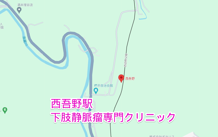 西吾野駅から行く下肢静脈瘤専門クリニック