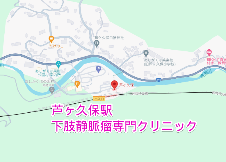 芦ヶ久保駅から行く下肢静脈瘤専門クリニック
