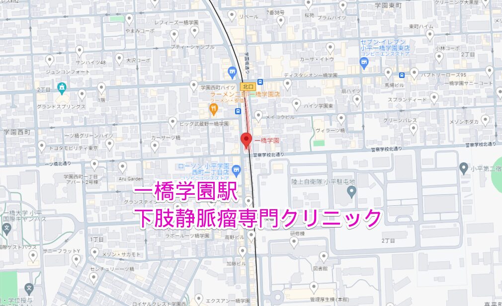 一橋学園駅から行く下肢静脈瘤専門クリニック