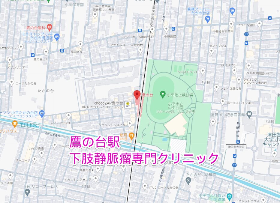 鷹の台駅から行く下肢静脈瘤専門クリニック