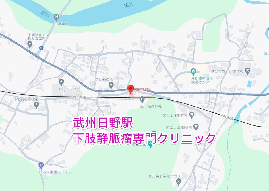 武州日野駅から行く下肢静脈瘤専門クリニック