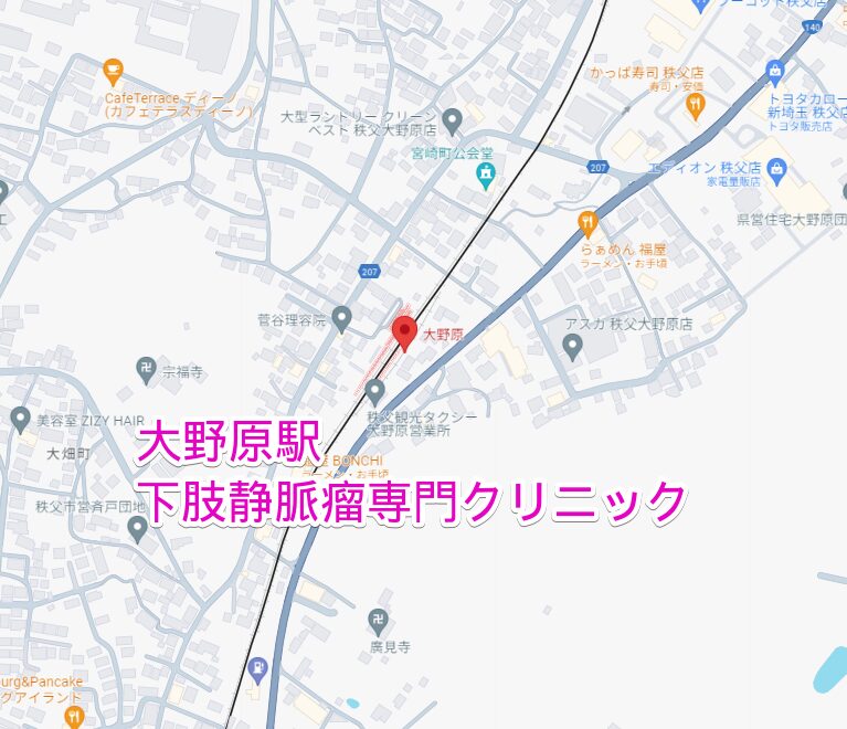 大野原駅から行く下肢静脈瘤専門クリニック