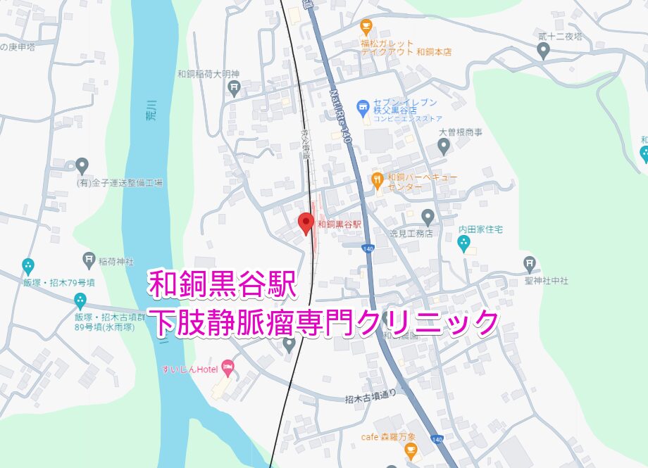 和銅黒谷駅から行く下肢静脈瘤専門クリニック