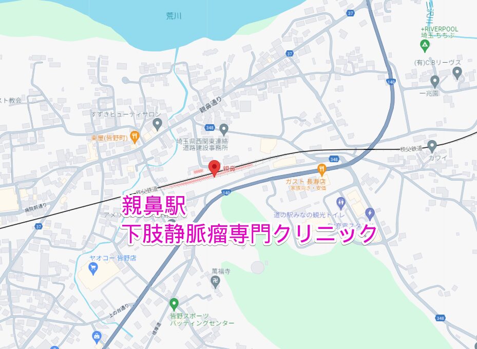親鼻駅から行く下肢静脈瘤専門クリニック