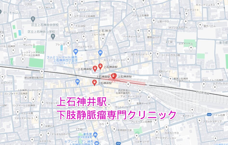 上石神井駅周辺の下肢静脈瘤専門クリニック