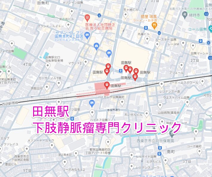 田無駅周辺の下肢静脈瘤専門クリニック