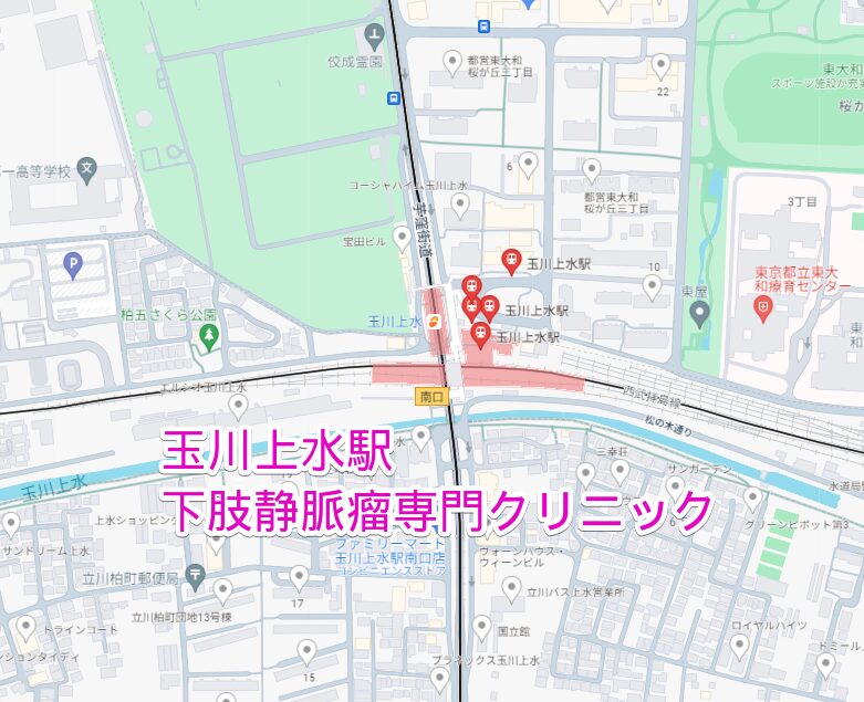 玉川上水駅周辺の下肢静脈瘤専門クリニック