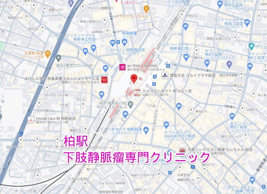 柏駅から行くの下肢静脈瘤専門クリニック