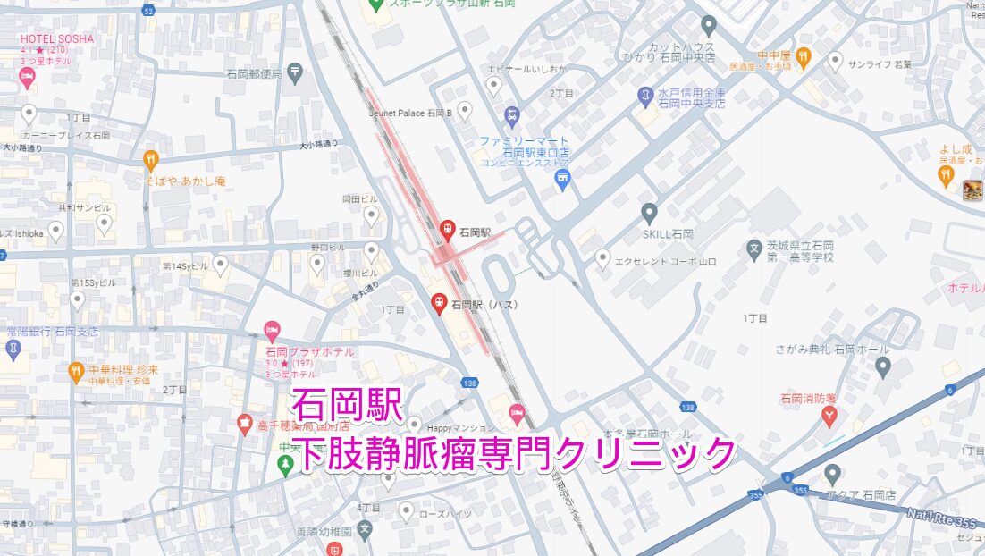 石岡駅から行く下肢静脈瘤専門クリニック