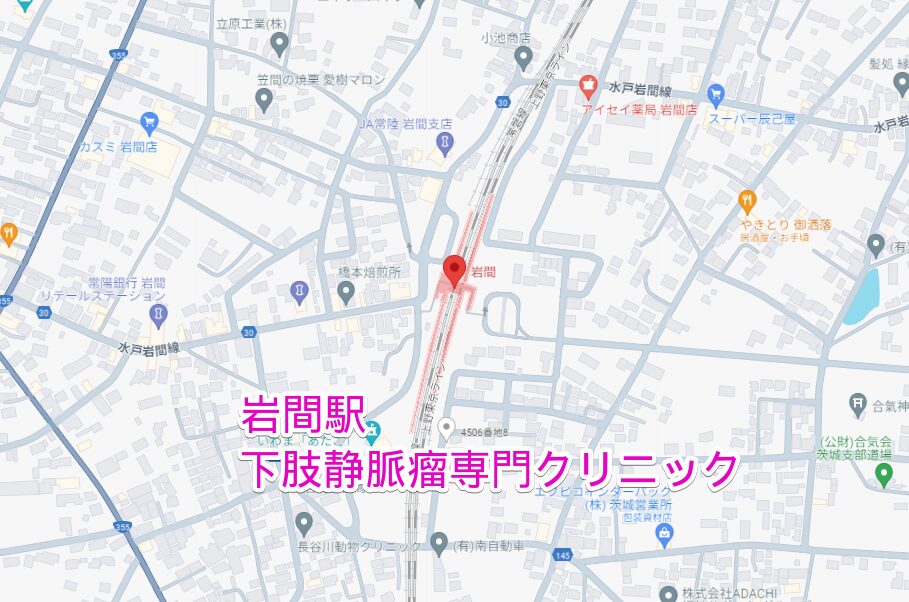岩間駅から行く下肢静脈瘤専門クリニック