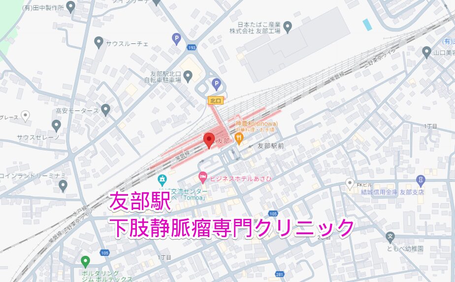 友部駅周辺から行く下肢静脈瘤専門クリニック