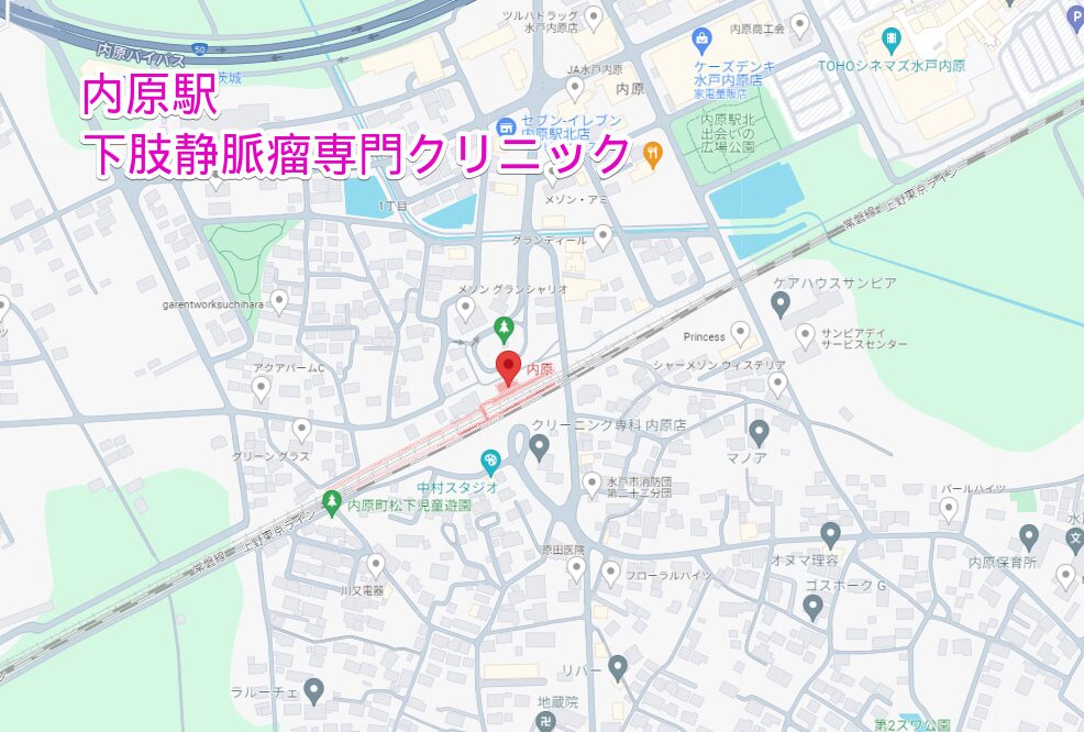 内原駅周辺から行く下肢静脈瘤専門クリニック