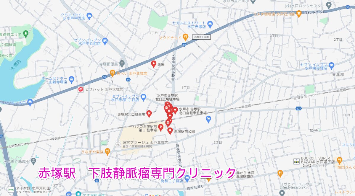 赤塚駅から行く下肢静脈瘤専門クリニック