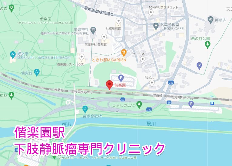 偕楽園駅から行く下肢静脈瘤専門クリニック