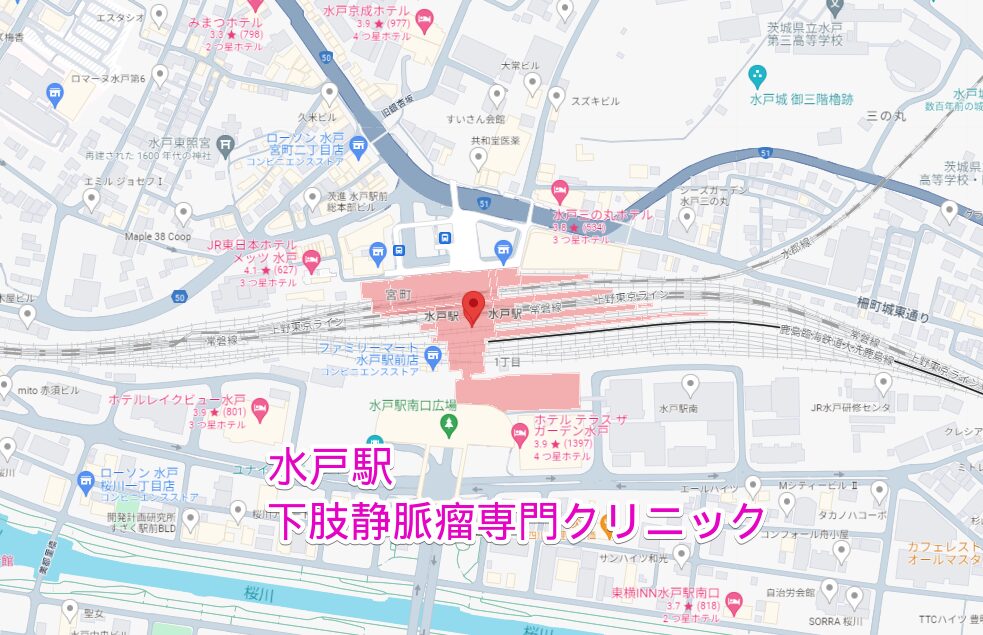 水戸駅から行く下肢静脈瘤専門クリニック