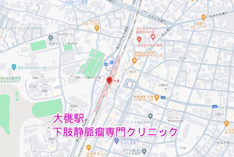 大甕駅周辺から行く下肢静脈瘤専門クリニック