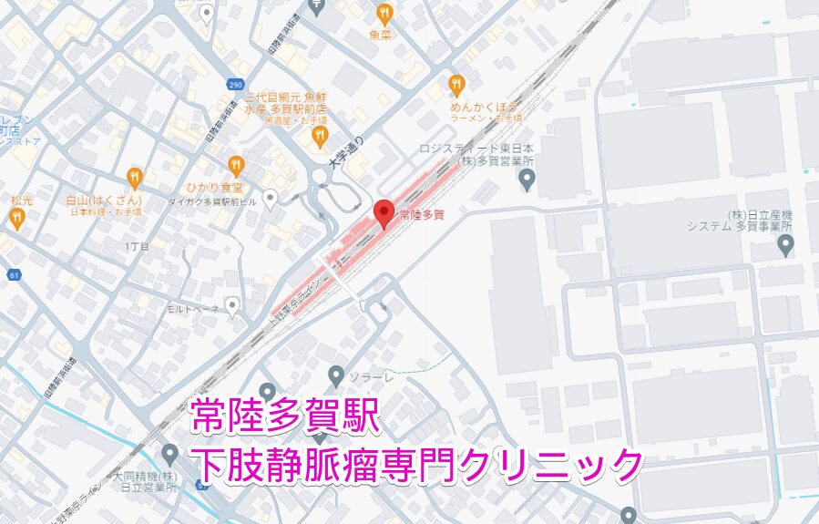 常陸多賀駅から行く下肢静脈瘤専門クリニック