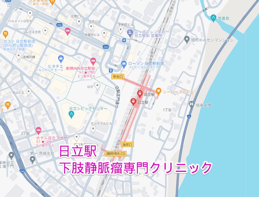 日立駅周辺から行く下肢静脈瘤専門クリニック