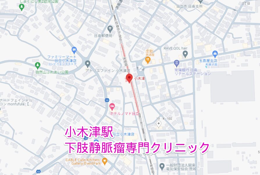小木津駅周辺から行く下肢静脈瘤専門クリニック