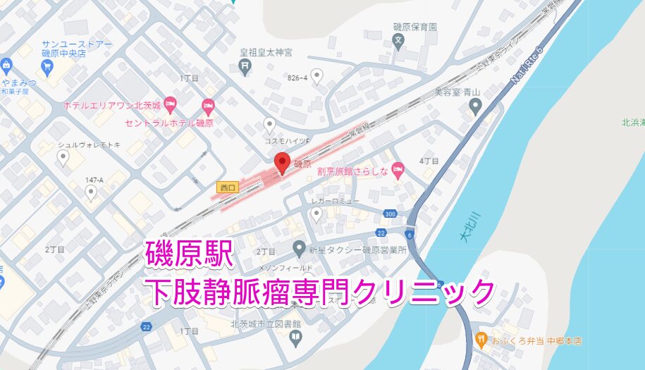 磯原駅周辺から行く下肢静脈瘤専門クリニック