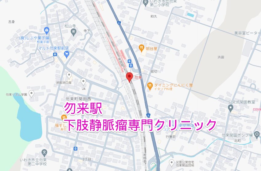 勿来駅周辺から行く下肢静脈瘤専門クリニック