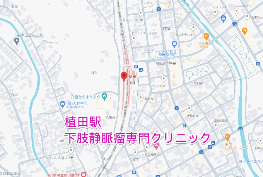 植田駅周辺から行く下肢静脈瘤専門クリニック
