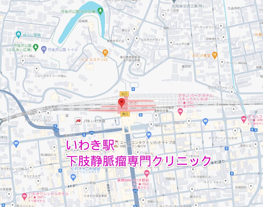 いわき駅周辺から行く下肢静脈瘤専門クリニック