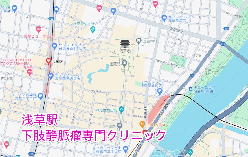 浅草駅周辺から行く下肢静脈瘤専門クリニック