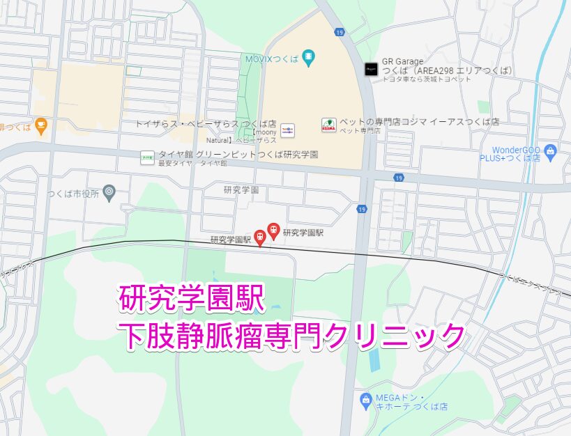 研究学園駅周辺から行く下肢静脈瘤専門クリニック