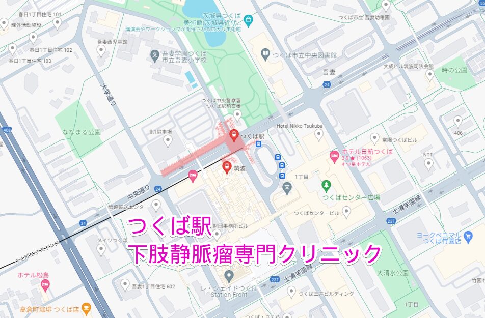 つくば駅周辺から行く下肢静脈瘤専門クリニック