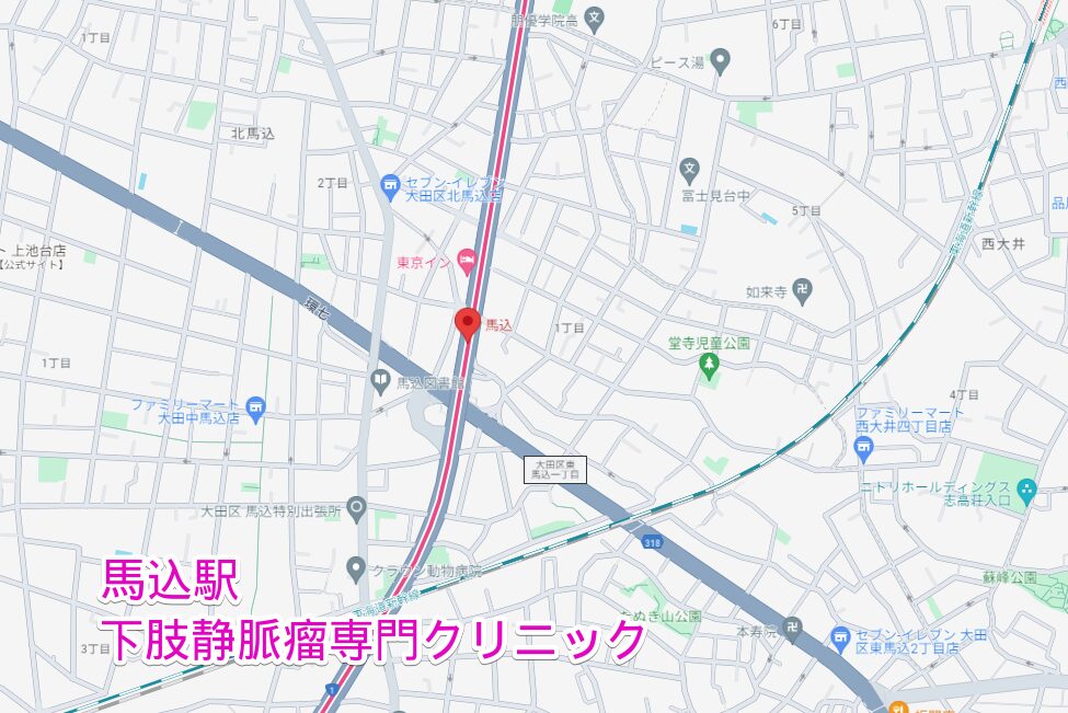 馬込駅周辺から行く下肢静脈瘤専門クリニック