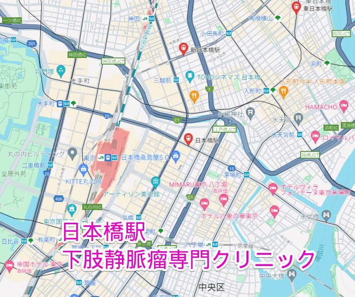 日本橋駅周辺の下肢静脈瘤専門クリニック