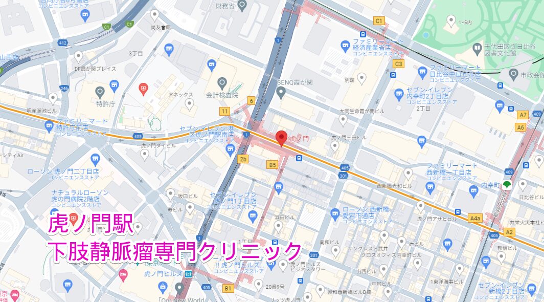 虎ノ門駅周辺の下肢静脈瘤専門クリニック