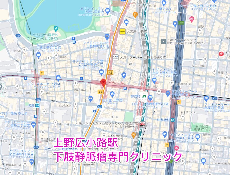 上野広小路駅周辺の下肢静脈瘤専門クリニック