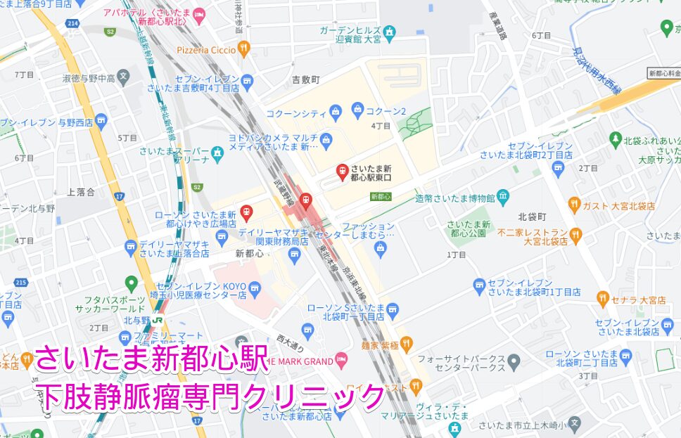 さいたま新都心駅周辺の下肢静脈瘤専門クリニック