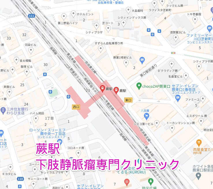 蕨駅周辺の下肢静脈瘤専門クリニック