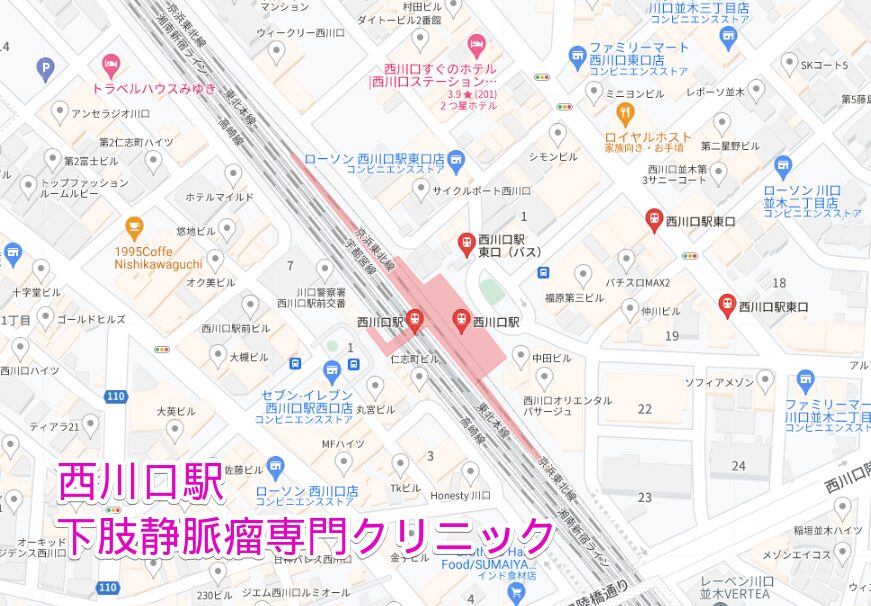 西川口駅周辺の下肢静脈瘤専門クリニック