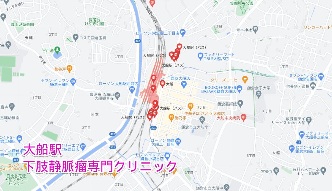 大船駅周辺の下肢静脈瘤専門クリニック