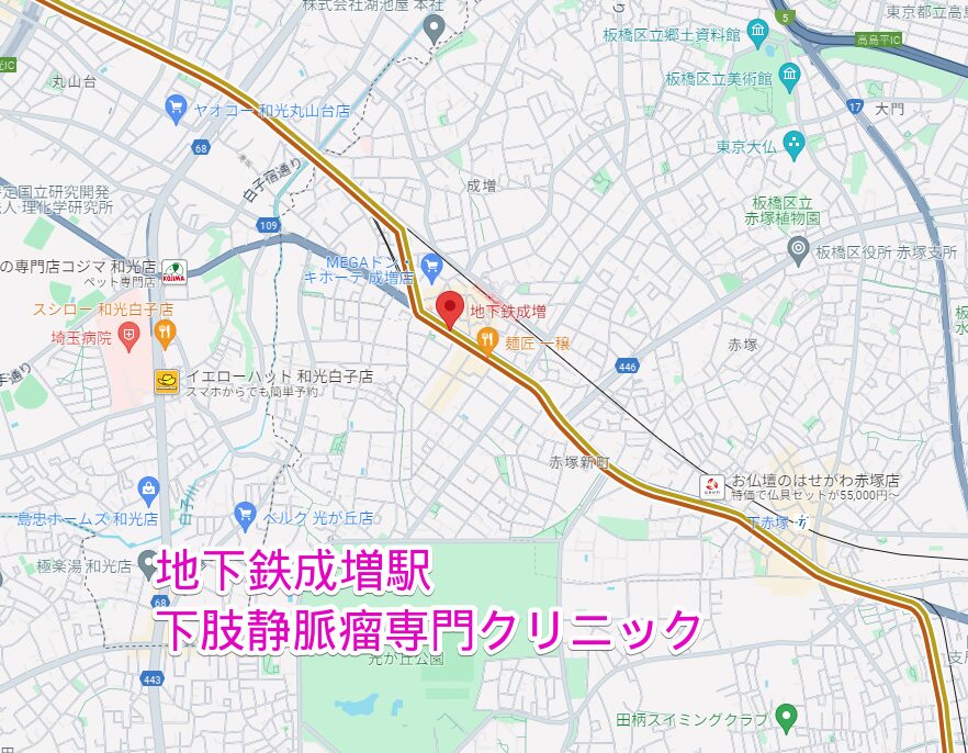 地下鉄成増駅周辺の下肢静脈瘤専門クリニック